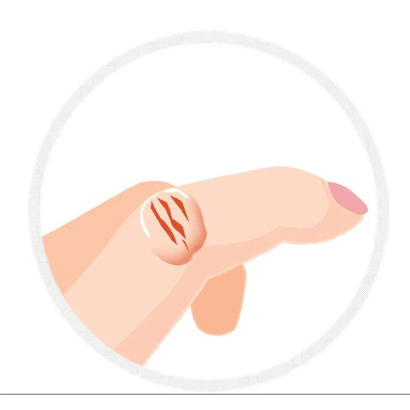 Thumb 5